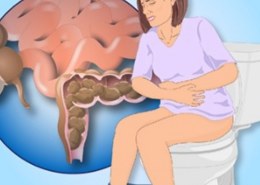 How to relieve constipation?