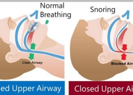 How to stop snoring?