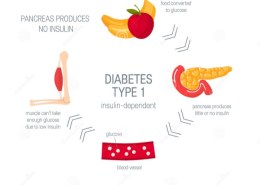 What Are the Causes of Type 1 Diabetes?