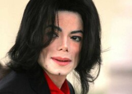 Why did Michael Jackson’s skin turn white?